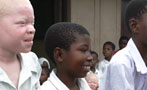 How Many Albinos Are There in Tanzania, Anyway?