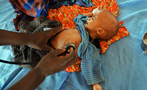 Devastating Photos of the Famine in Somalia