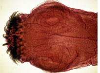 Head of a tape worm
Click on image to expand.
