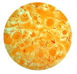 Mycobacterium tuberculosis (stained red) in sputum. Click image to expand.