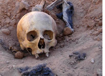 A human skull