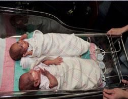 Premature twins. Click image to expand.