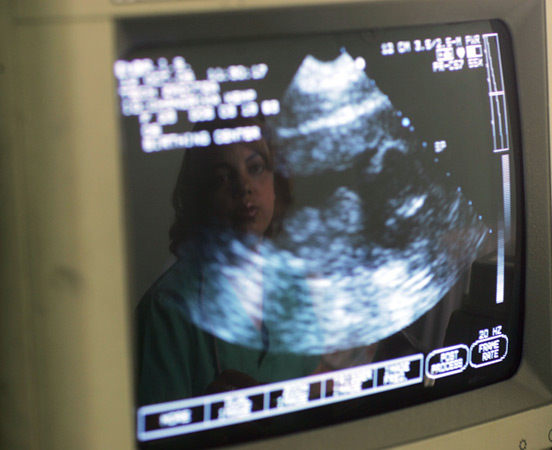 An ultrasound machine.
