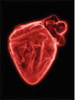 X-ray of heart