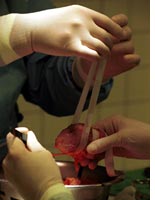 Kidney swap. Click image to expand.