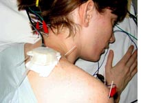 Starting the day with acupuncture. Click image to expand.