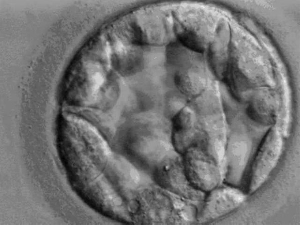 A blastocyst on day 5 after fertilization.