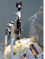 Deep brain stimulation. Click image to expand.