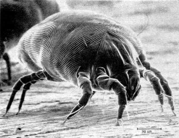 Dermatophagoides pteronyssinus, or a dust mite.