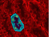 Kidney tubules under the microscope