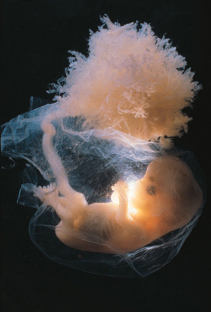 Embryo.