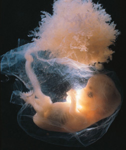 Embryo. Click image to expand.