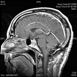 Post. Click image to expand.