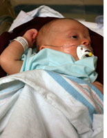 Walker with oxygen tubes
Click image to expand.