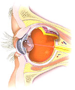 An eye into the eye