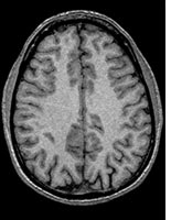 The brain: a tough nut to crack. 
Click image to expand.