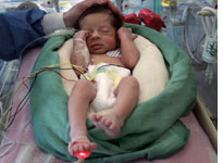 Premature baby. Click image to expand.