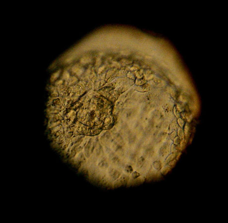 Human embryo.