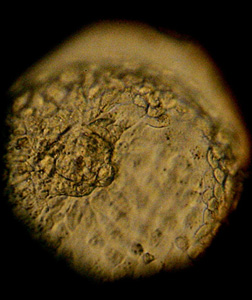 Human embryo. Click image to expand.
