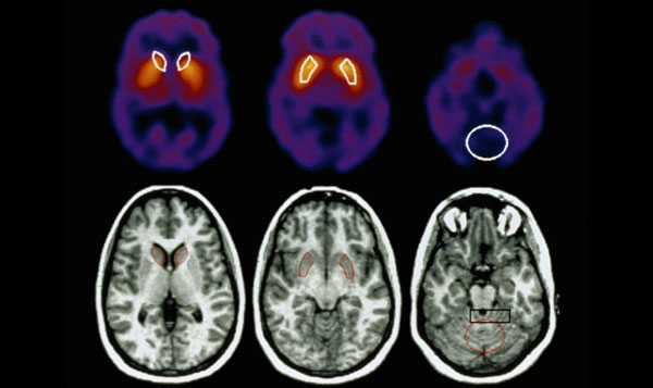Brain scans.