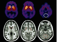 Brain scans. Click image to expand.