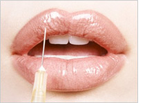 Photograph of lips being injected by Digital Vision.