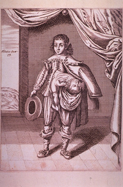 A boy with a partial twin growing from his side, 1686. Click image to expand.