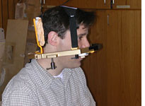 Immobilization frame with custom-fitted bite plate