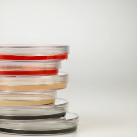 Petri dishes.