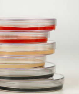 Petri dish. Click image to expand.
